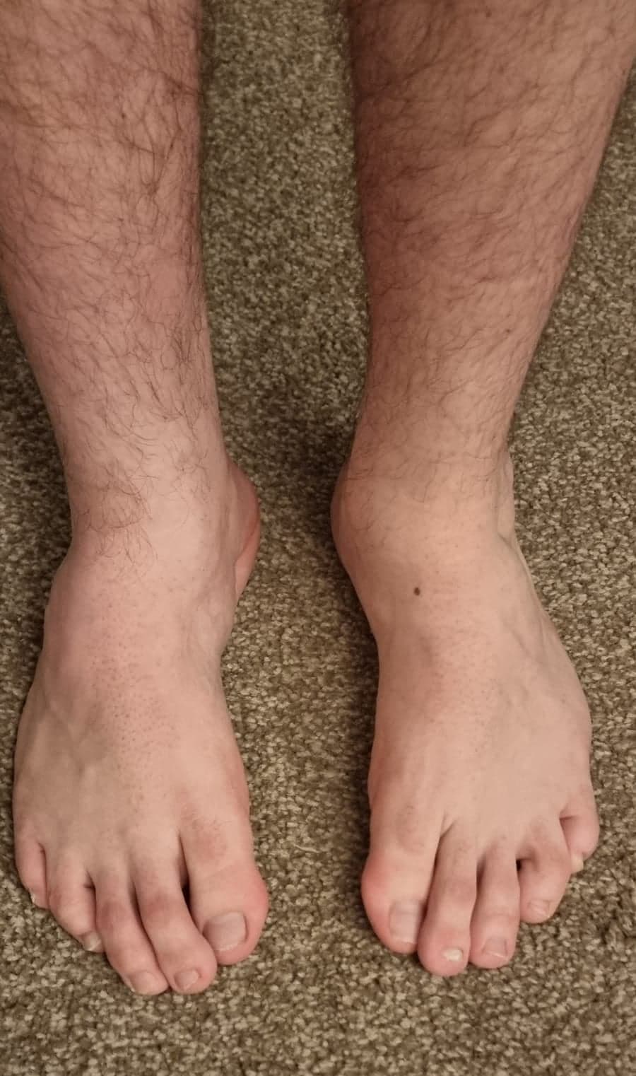 Finding my feet Picture 2 Finding my feet